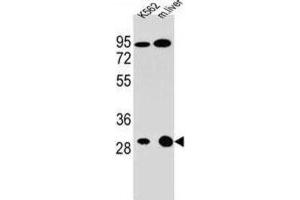 Western Blotting (WB) image for anti-Electron-Transfer-Flavoprotein, alpha Polypeptide (ETFA) antibody (ABIN2996035) (ETFA antibody)