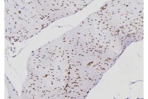 ABIN6269016 at 1/100 staining Human gastric tissue by IHC-P. (Ku70/80 antibody)
