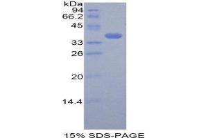 SDS-PAGE (SDS) image for Cystatin A (Stefin A) (CSTA) (AA 1-97) protein (His tag,GST tag) (ABIN1821594)