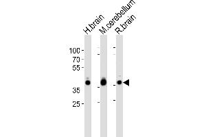 Western blot analysis of lysates from human brain, mouse cerebellum and rat brain tissue lysate (from left to right), using ALDOC Antibody (C-term) (ABIN389207 and ABIN2839365).