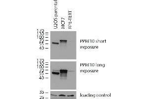 Western blotting analysis of human PPM1D using mouse monoclonal antibody 7E11/C5 on lysates of U2OS parental cells, expressing both natural (70 kDa, low expression) and C-terminally truncated version (55 kDa, high expression) of PPM1D, and on lysates of MCF7 cells (high PPM1D expression) and RPE cells (low PPM1D expression), reducing conditions. (PPM1D antibody)