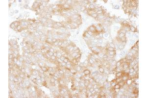 Immunohistochemistry (IHC) image for anti-Solute Carrier Family 9, Subfamily A (NHE3, Cation Proton Antiporter 3), Member 3 Regulator 1 (SLC9A3R1) (AA 275-325) antibody (ABIN7453743)