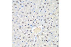 Immunohistochemistry of paraffin-embedded rat liver using WDR48 antibody (ABIN5974731) at dilution of 1/100 (40x lens). (WDR48 antibody)
