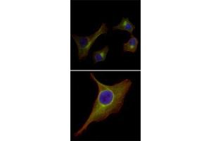Immunofluorescence analysis of HepG2 (upper) and PACN-1 (bottom) cells using KRT15 monoclonal antibody, clone 6E7  (green) .