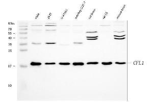 Western blot analysis of Cofilin using anti-Cofilin antibody (ABIN3042746). (Cofilin antibody  (C-Term))