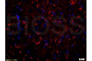 Formalin-fixed and paraffin-embedded rat brain labeled with Anti-CDH2/N-cadherin Polyclonal Antibody, Unconjugated (ABIN738726) 1:200, overnight at 4°C, The secondary antibody was Goat Anti-Rabbit IgG, PE conjugated used at 1:200 dilution for 40 minutes at 37°C. (N-Cadherin antibody  (AA 701-800))