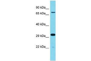 Western Blotting (WB) image for anti-Olfactory Receptor 364, Pseudogene 1 (OLFR364-PS1) (C-Term) antibody (ABIN2788163)