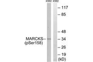 Western blot analysis of extracts from K562 cells treated with EGF 200ng/ml 30', using MARCKS (Phospho-Ser158) Antibody. (MARCKS antibody  (pSer159))