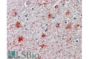 ABIN571021 (3. (P2RX7 antibody  (N-Term))