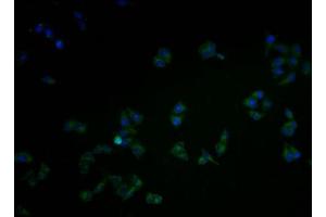 Immunofluorescence staining of Hela cells with ABIN7146440 at 1:100, counter-stained with DAPI. (CAMK2A antibody  (AA 321-478))