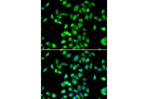 Immunofluorescence analysis of MCF7 cells using Kallistatin (SERPIN) antibody (ABIN6131346, ABIN6147573, ABIN6147574 and ABIN6223161). (SERPINA4 antibody  (AA 178-427))