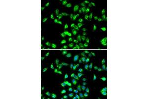 Immunofluorescence analysis of MCF7 cells using Kallistatin (SERPIN) antibody (ABIN6131346, ABIN6147573, ABIN6147574 and ABIN6223161). (SERPINA4 antibody  (AA 178-427))