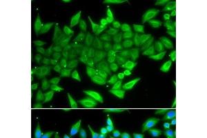 Immunofluorescence analysis of A549 cells using TTF2 Polyclonal Antibody