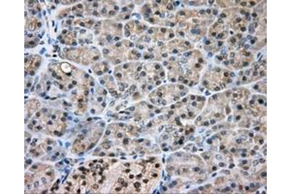 NIT2 antibody