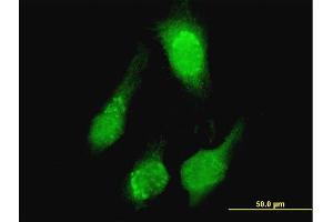 Immunofluorescence of purified MaxPab antibody to TCL1A on HeLa cell. (TCL1A antibody  (AA 1-114))