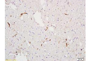Formalin-fixed and paraffin embedded rat tibia tissue labeled with Anti-Factor VIII (FVIII) Polyclonal Antibody , Unconjugated at 1:300, followed by conjugation to the secondary antibody and DAB staining