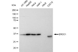 Western blotting analysis using ERCC1 antibody (ABIN7798539). (Recombinant ERCC1 antibody)