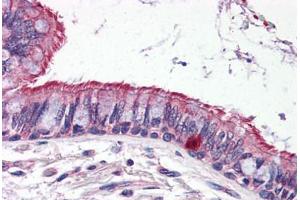 Human Lung (formalin-fixed, paraffin-embedded) stained with ELOVL6 antibody ABIN343916 at 5 ug/ml followed by biotinylated goat anti-rabbit IgG secondary antibody ABIN481713, alkaline phosphatase-streptavidin and chromogen. (ELOVL6 antibody  (N-Term))