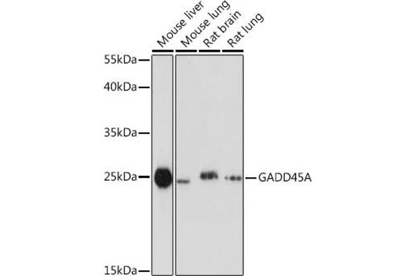 GADD45A Antikörper  (AA 1-165)