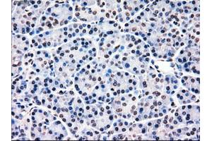 Immunohistochemical staining of paraffin-embedded Ovary tissue using anti-MRI1mouse monoclonal antibody. (MRI1 antibody)