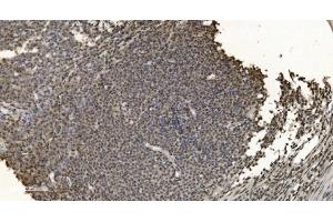 IHC analysis of HNRNPH3 using anti-HNRNPH3 antibody (ABIN7601121). (HNRNPH3 antibody  (AA 29-268))