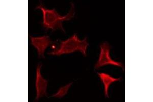 ABIN6275678 staining 293 by IF/ICC. (CACNA2D4 antibody  (Internal Region))