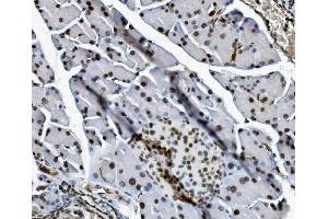 IHC analysis of Transketolase/TKT using anti-Transketolase/TKT antibody (ABIN7598958). (TKT antibody  (AA 1-116))