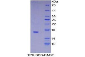 SDS-PAGE (SDS) image for Pre-B Lymphocyte 1 (VPREB1) (AA 43-134) protein (His tag) (ABIN2126392)