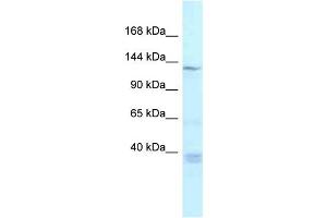 WB Suggested Anti-Tnks Antibody Titration: 1. (TNKS antibody  (Middle Region))