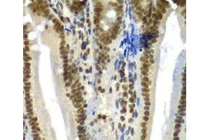 Immunohistochemistry of paraffin-embedded Mouse Intestine using SF3B2 Polyclonal Antibody at dilution of 1:100 (40x lens). (SF3B2 antibody)