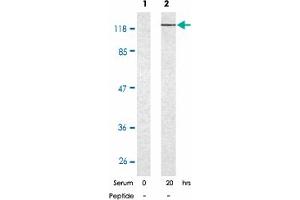 Western blot analysis of extract from K-562 cells untreated or treated with 10% serum after 48 hours of starvation, using RB1 (phospho S780) polyclonal antibody . (Retinoblastoma 1 antibody  (pSer780))