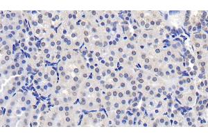Detection of NUMA1 in Human Kidney Tissue using Monoclonal Antibody to Nuclear Mitotic Apparatus Protein 1 (NUMA1) (NUMA1 antibody  (AA 1700-2115))