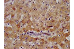IHC image of ABIN7143624 diluted at 1:700 and staining in paraffin-embedded human liver tissue performed on a Leica BondTM system. (AGXT2 antibody  (AA 196-328))
