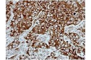 Immunohistochemistry: PPP3CB antibody staining of Paraffin-Embedded H661 Xenograft at 1/500 dilution. (PPP3CB antibody)