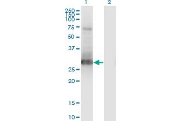 PRRX1 Antikörper  (AA 1-90)