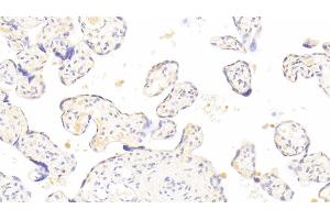 Detection of PAPPA in Human Placenta Tissue using Polyclonal Antibody to Pregnancy Associated Plasma Protein A (PAPPA) (PAPPA antibody  (AA 317-532))