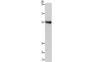 Gel: 6 % SDS-PAGE, Lysate: 40 μg, Lane: Human fetal brain tissue, Primary antibody: ABIN7191717(NRG3 Antibody) at dilution 1/200, Secondary antibody: Goat anti rabbit IgG at 1/8000 dilution, Exposure time: 2 minutes (Neuregulin 3 antibody)