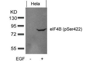 Western blot analysis of extracts from Hela cells untreated or treated with EGF using eIF4B(phospho-Ser422) Antibody. (EIF4B antibody  (pSer422))