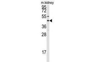 Image no. 1 for anti-Gap Junction Protein, alpha 8, 50kDa (GJA8) (C-Term) antibody (ABIN357099) (GJA8 antibody  (C-Term))
