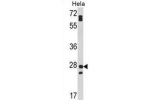 Western Blotting (WB) image for anti-Family with Sequence Similarity 3, Member B (FAM3B) antibody (ABIN3002861) (FAM3B antibody)