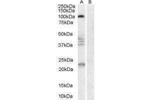 ABIN185403 (0. (RTN4R antibody  (Internal Region))