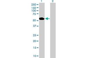 Western Blot analysis of ABLIM1 expression in transfected 293T cell line by ABLIM1 MaxPab polyclonal antibody. (ABLIM1 antibody  (AA 1-401))