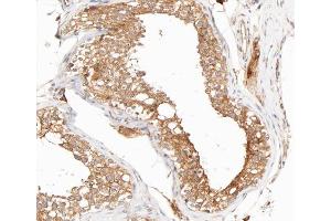 ABIN6267704 at 1/200 staining human testis tissue sections by IHC-P. (IKBKG antibody  (pSer31))