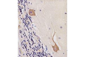 (ABIN6244287 and ABIN6577245) staining CK2 in human cerebellum tissue sections by Immunohistochemistry (IHC-P - paraformaldehyde-fixed, paraffin-embedded sections). (CAMK2B antibody  (AA 1-503))