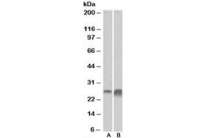 Western blot testing of human kidney [A] and liver [B] lysate with APOD antibody at 0. (Apolipoprotein D antibody)