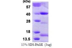 Nth Endonuclease III-Like 1 (NTHL1) (AA 1-312) protein (His tag)