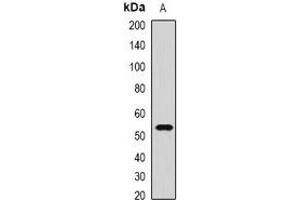 Western blot analysis of CMG2 expression in PC3 (A) whole cell lysates.
