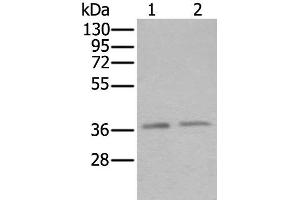 Western blot analysis of Hela and Raji cell lysates using ATXN7L3 Polyclonal Antibody at dilution of 1:500 (ATXN7L3 antibody)