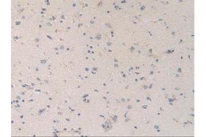 Figure. (MAPKAP Kinase 2 antibody  (AA 139-367))
