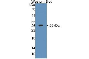 Western blot analysis of the recombinant protein. (IL27 Receptor alpha antibody  (AA 93-273))